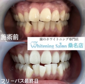 【理想の白さへ】