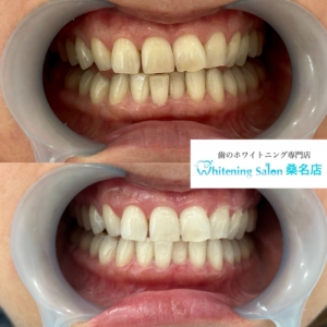【着色汚れ落としませんか？】