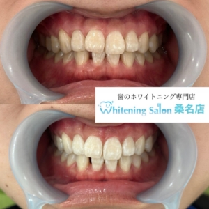 【カルシウム取れていますか？】