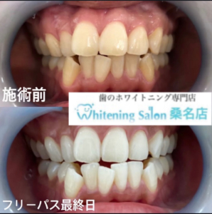 【大人気！効果大☆】