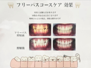 【今までの着色汚れ綺麗に落としませんか!?】