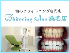 【歯のホワイトニング専門店♪】