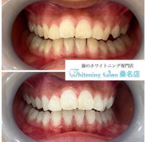 【セルフスタイルでお気軽に☆】