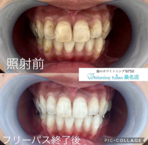 【半永久的効果☆】