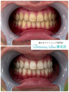 【笑顔が増えました】