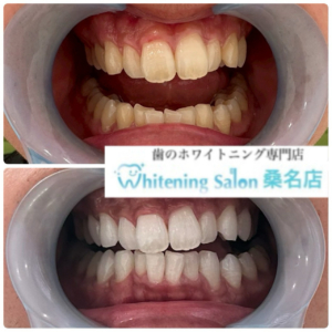 【3週間で綺麗に】