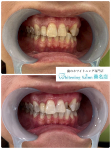 【まだ諦めないで】