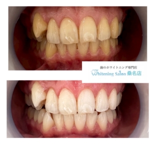【ブライダルも人気です】