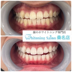 【回数を重ねれば】