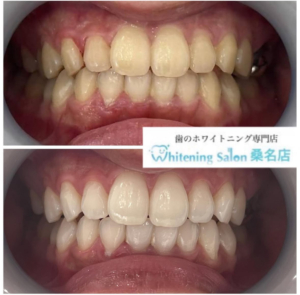 【素敵な笑顔に】