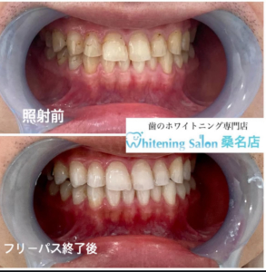 【印象up目指しませんか!?】