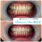 【回数券としても使えます！】