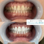 ［白い歯で新年を迎えましょう］