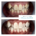 【通うのが楽しみになるホワイトニング】