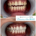 【清潔感は口もとから】