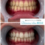 【早めの準備も大切です】