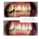 【口元は案外見られてます】