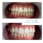 【ちょっとしたケアが大切です】