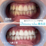 【セルフでも効果抜群】