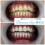 【素敵な笑顔に】