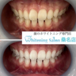 【しっかりと効果を実感】