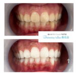 【一生に一度の大切な日のためにも！】