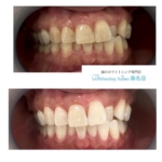 【暖かくなってきましたね】