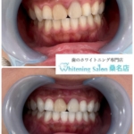 【継続が大切です】