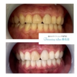 【口コミお待ちしています☆】