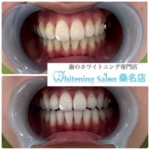 【お得に白くキレイに】