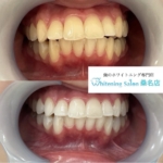 【着色汚れを落としましょう】