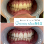 【お口元に自信が持てます♪】