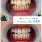 【花嫁美容にも♪】