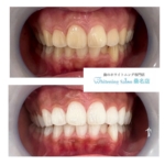 【何回で白くなる？】