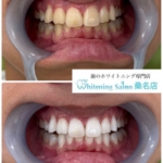 着色汚れの予防策