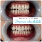 ２回目のフリーパス