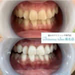 【本来の白さに‪☆】